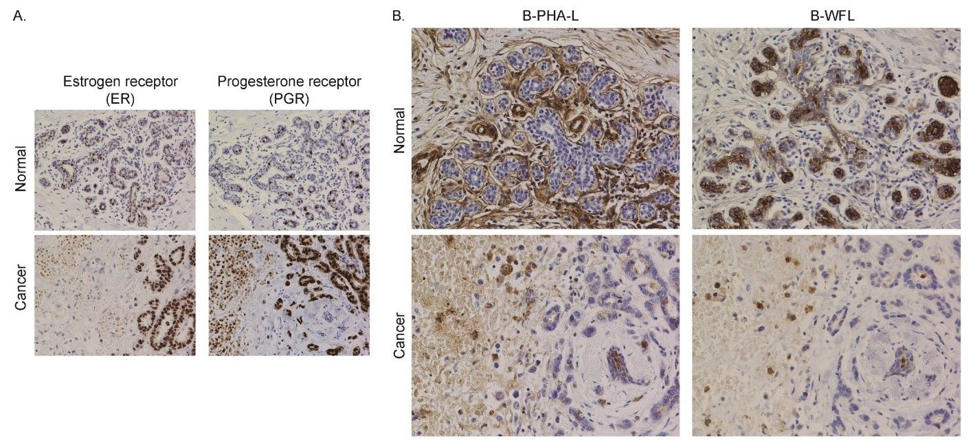 Glysite Scout breast cancer figure