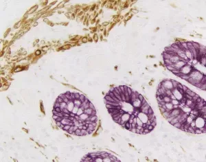 VECTASTAIN Blog Post Image 1 300x236 1