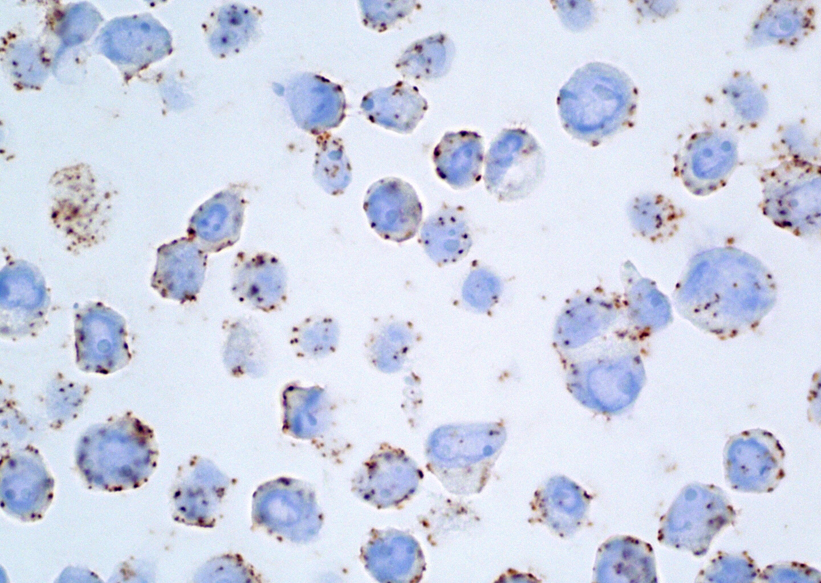 BT474 Cell Pellet Edited