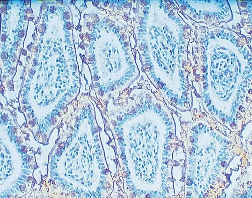 Lectins Blog 2 IHC 1000x786 1