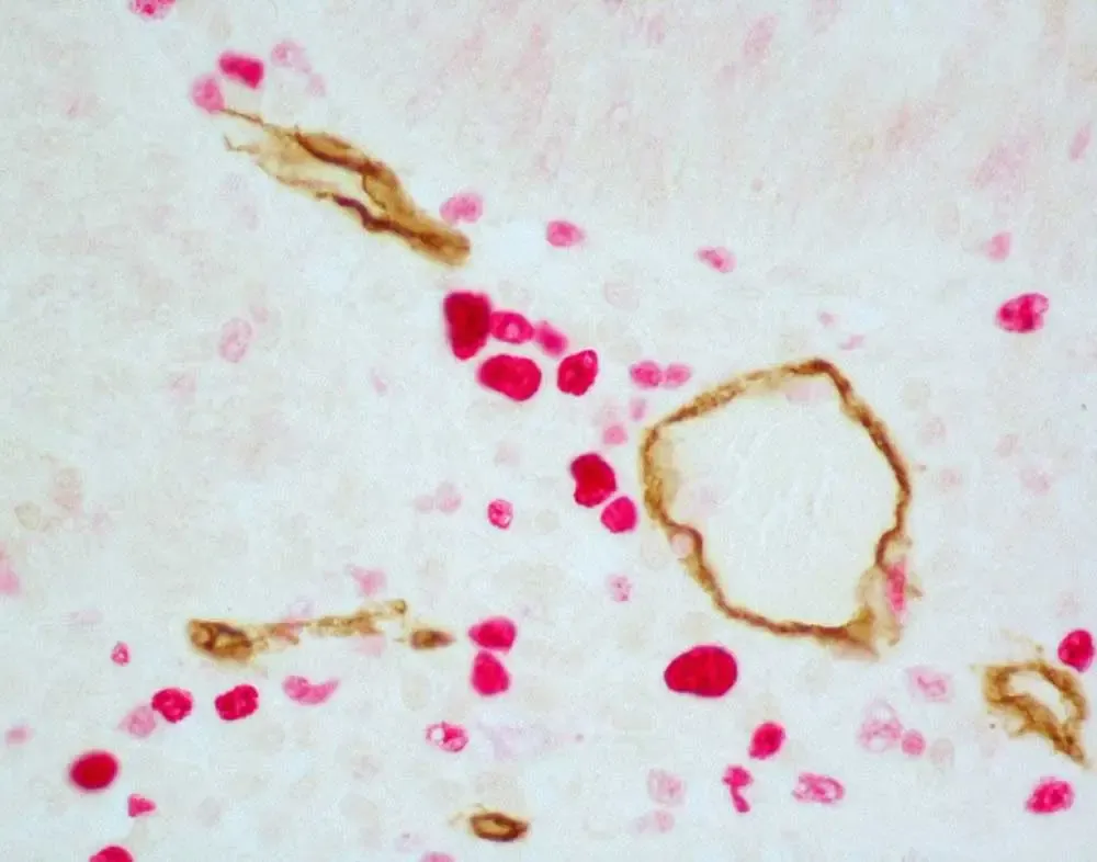 4 Colon ImmPress 1000x786 1