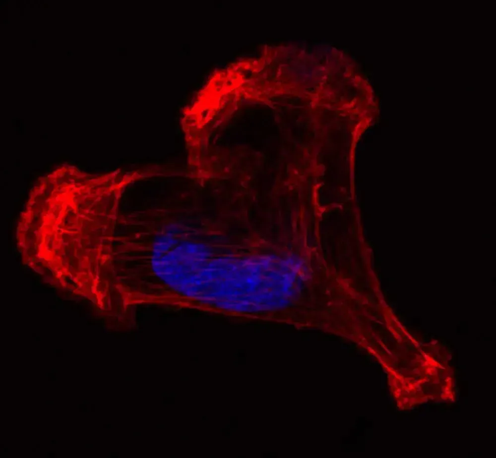 RosaFontana MDA cytoskeleton RF 2