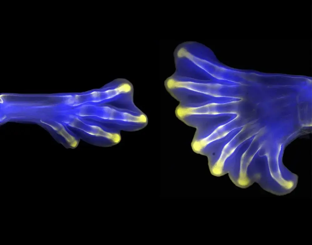 3 Hindlimbs Childrens 1000x786 1